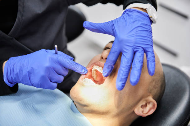 Best Emergency Wisdom Teeth Removal in North Granby, CT